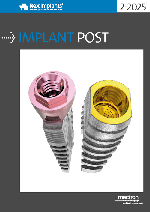 Implant Post 2025-2